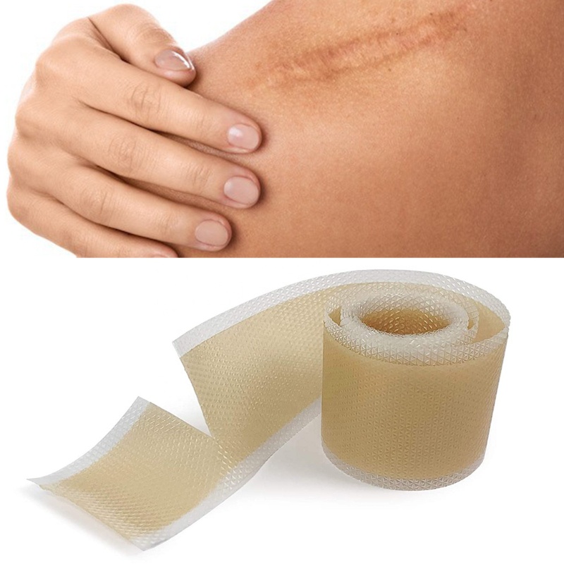 Youyo Tấm Silicone Hỗ trợ giảm sẹo Chống Thấm Nước An Toàn Không Độc Hại Cho Người Lớn Và Trẻ Em Ava