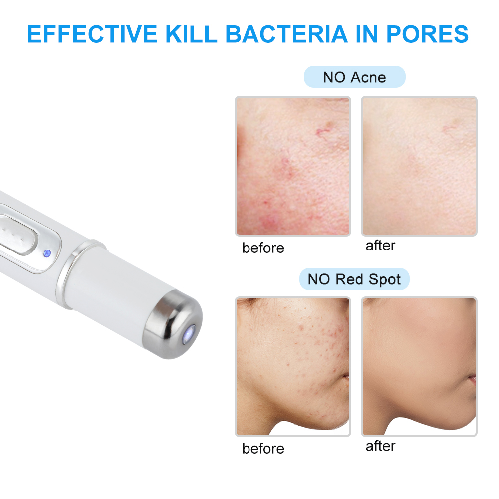 [Hàng mới về] Bút laser ánh sáng xanh giúp giảm mụn xóa mờ nếp nhăn Kd-7910