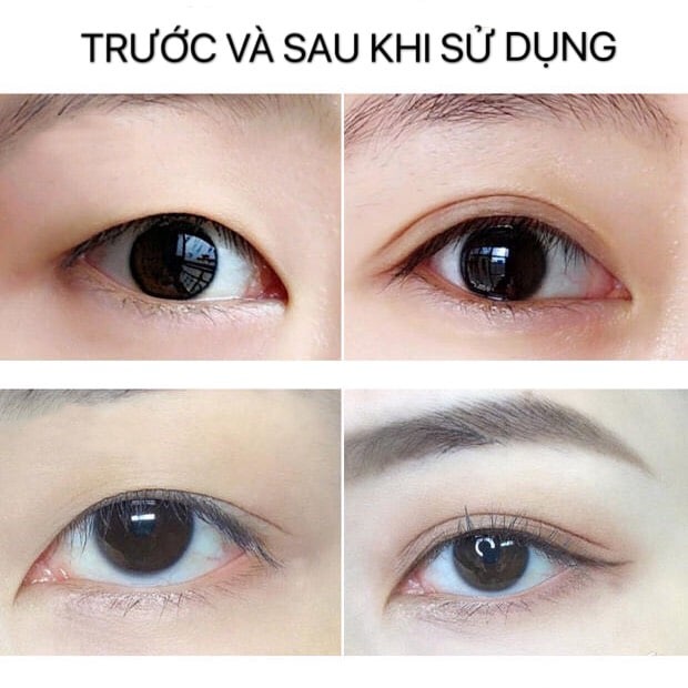 Gel kích mí LIPHOP nhấn mí tạo mắt hai mí tự nhiên tiện lợi an toàn | BigBuy360 - bigbuy360.vn