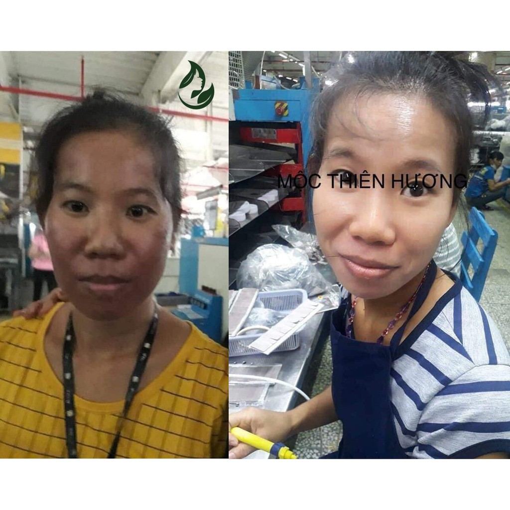 Serum giảm mụn thâm rỗ, sáng da, se khít lỗ chân lông Mộc Thiên Hương 50ml | BigBuy360 - bigbuy360.vn