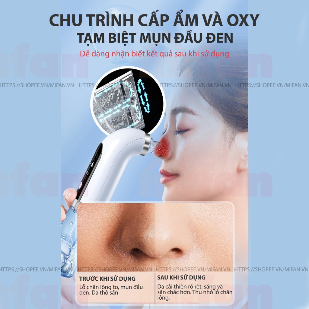 Máy Hút Mụn Đầu Đen, Mụn Cám, Rửa Mặt, Làm Sạch Lỗ Chân Lông, Phun Oxy Dưỡng Ẩm Sáng Mịn Da [BH 6 Tháng] QStore