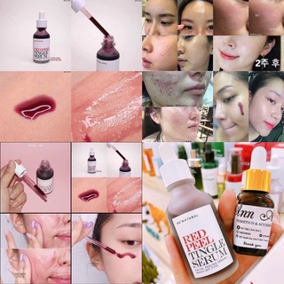 RED PEEL TINGLE SERUM