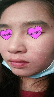 Thảo dược Đông y Sắc Mộc Lan