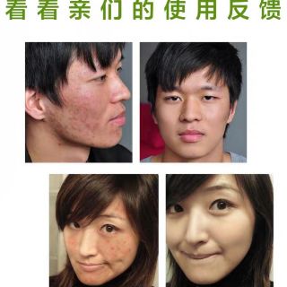 Đắp mặt Herborist