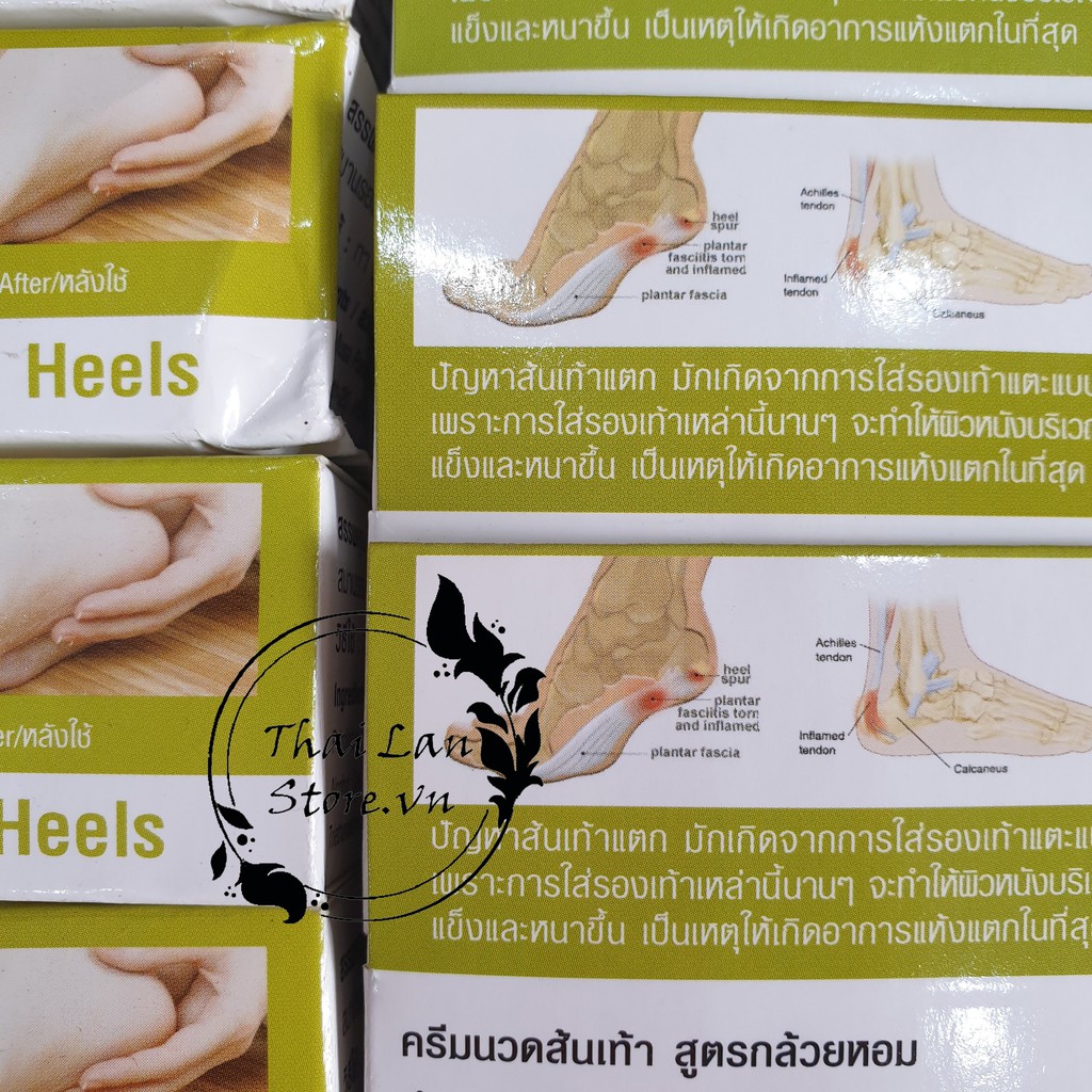 Kem Nẻ Gót Chân Banana Chuối Heel CREAM Thái Lan