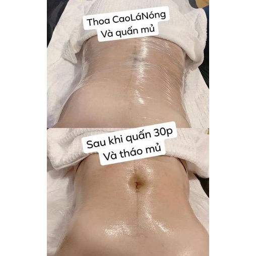 COMBO CAO LÁ NÓNG GIA TRUYỀN - GIẢM CÂN - TAN MỠ - RẠN 200ml