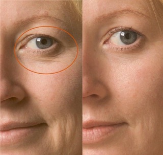 KEM DƯỠNG VIT A FORTE (RETINAL 0,1%) DR DIFFERENT