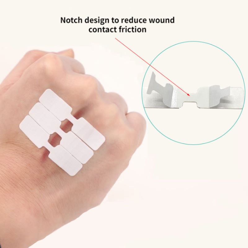 Bộ 10 Băng Keo Dán Vết Thương Bằng Nhựa Không Đường May
