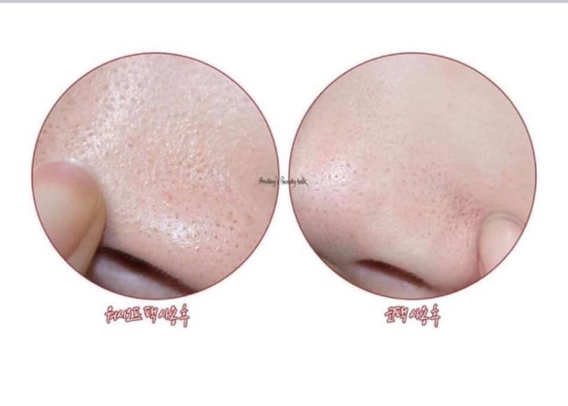 Thanh lăn mụn đầu đen Red Peel Clear Stick Hàn Quốc