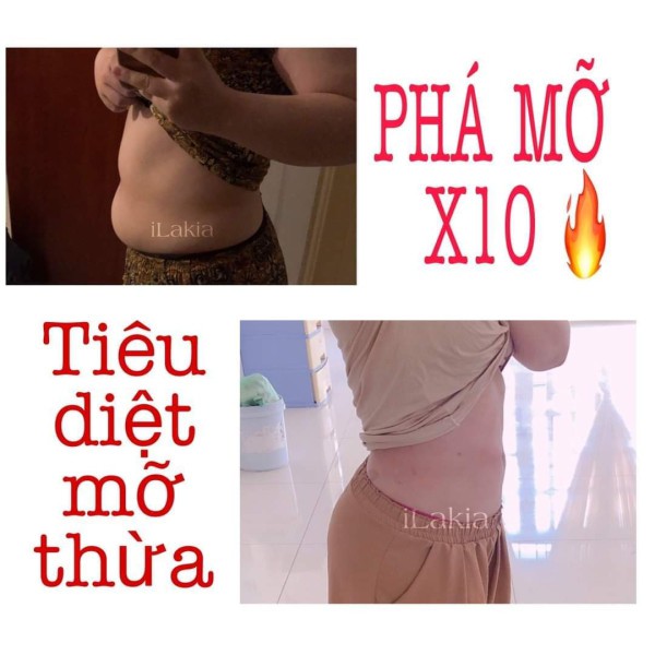 Kem Tan Mỡ Bụng ILAKIA Đánh Tan Mỡ Bụng Lấy Lại Dáng Sau Sinh Nhập Hàn Quốc | BigBuy360 - bigbuy360.vn