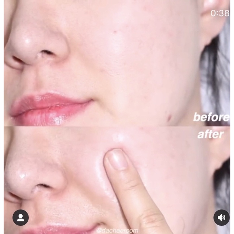 80ml  Tinh chất phục hồi da Bifida Biome Complex Ampoule