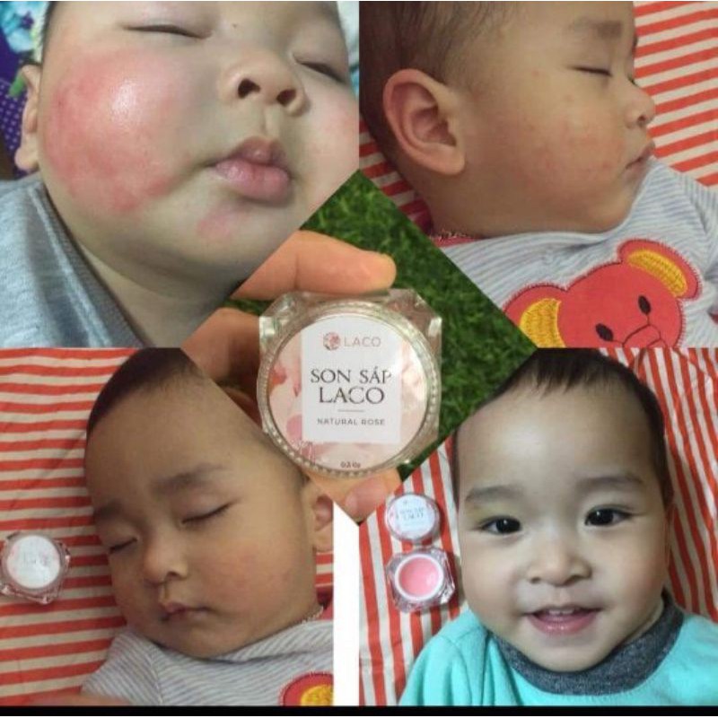 🔥Son Dưỡng Môi Laco🔥Làm Hồng Môi,Dưỡng Môi Mềm Mọng,Hết Khô Môi,Nứt Nẻ.100% Thiên Nhiên An Toàn Cho Cả Mẹ Và Bé 🔥 | BigBuy360 - bigbuy360.vn