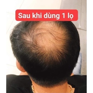 PHỦ BẠC NHANH CHÓNG THÀNH ĐEN LACO 200ML
