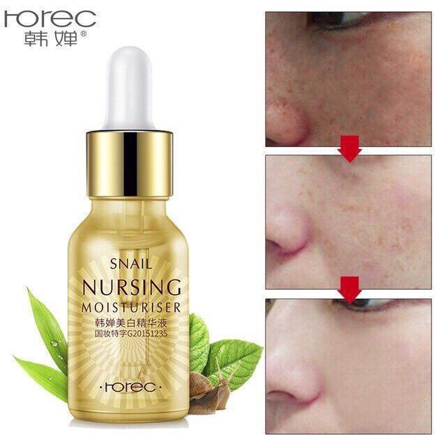 Serum Ốc Sên Dưỡng Da Làm Trắng Snail Nursing Rorec - BX2235