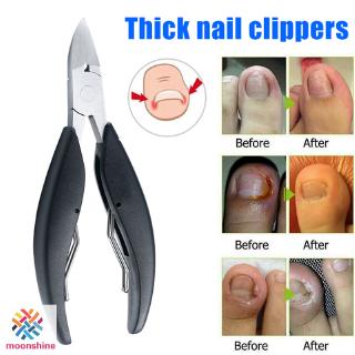 Kìm Cắt Móng Chân An Toàn Tiện Lợi