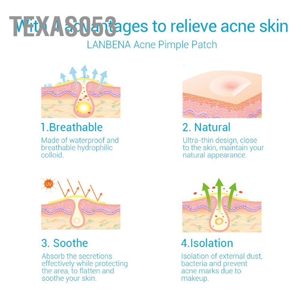 [Hàng mới về] 36 Miếng dán trong suốt sử dụng che khuyết điểm vùng mụn nhọt Texas053