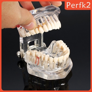 2x Human Mouth Dental Teeth Pathological Model Teaching Study Tools Clear