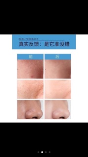 Serum se khít lỗ chân lông
