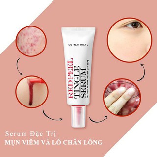 SERUM RED PEEL TINGLE