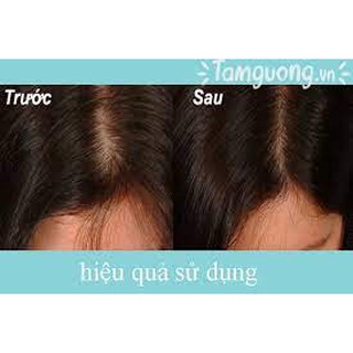 💖 HÀNG CHUẨN 💖 𝐂𝐚̣̆𝐩 𝐝𝐚̂̀𝐮 𝐠𝐨̣̂𝐢 đ𝐚̂̀𝐮 𝐭𝐫𝐢̣ 𝐫𝐮̣𝐧𝐠 𝐭𝐨́𝐜 , 𝐭𝐫𝐢̣ 𝐧𝐚̂́𝐦 𝐧𝐠𝐮̛́𝐚 𝐝𝐚 đ𝐚̂̀𝐮 𝐡𝐢𝐞̣̂𝐮 𝐪𝐮𝐚̉