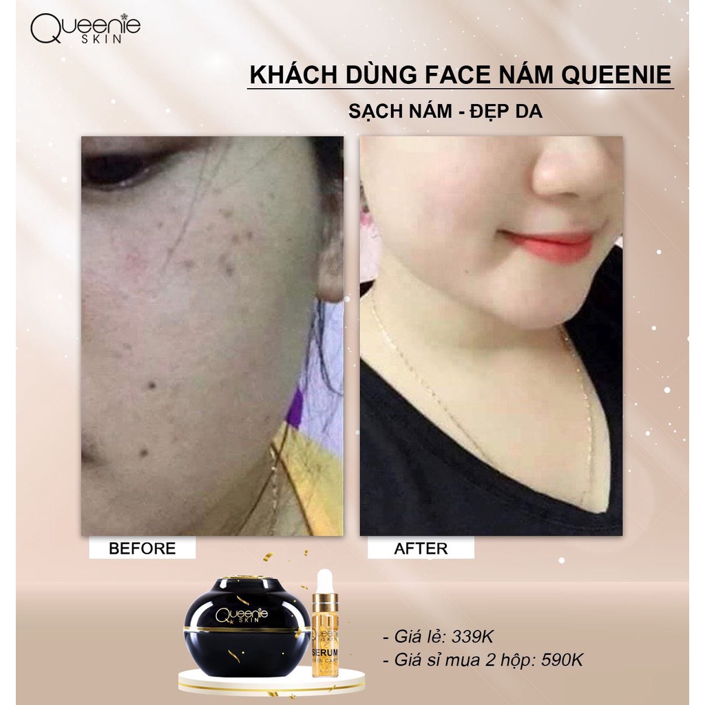 Tặng serum dưỡng kem giảm nám tàn nhang dưỡng trắng da mờ thâm sạm chống - ảnh sản phẩm 3