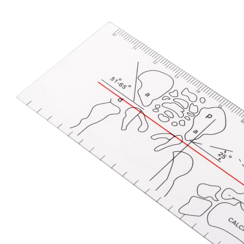 Thước Đo Góc Dùng Trong Y Tế Bằng Nhựa