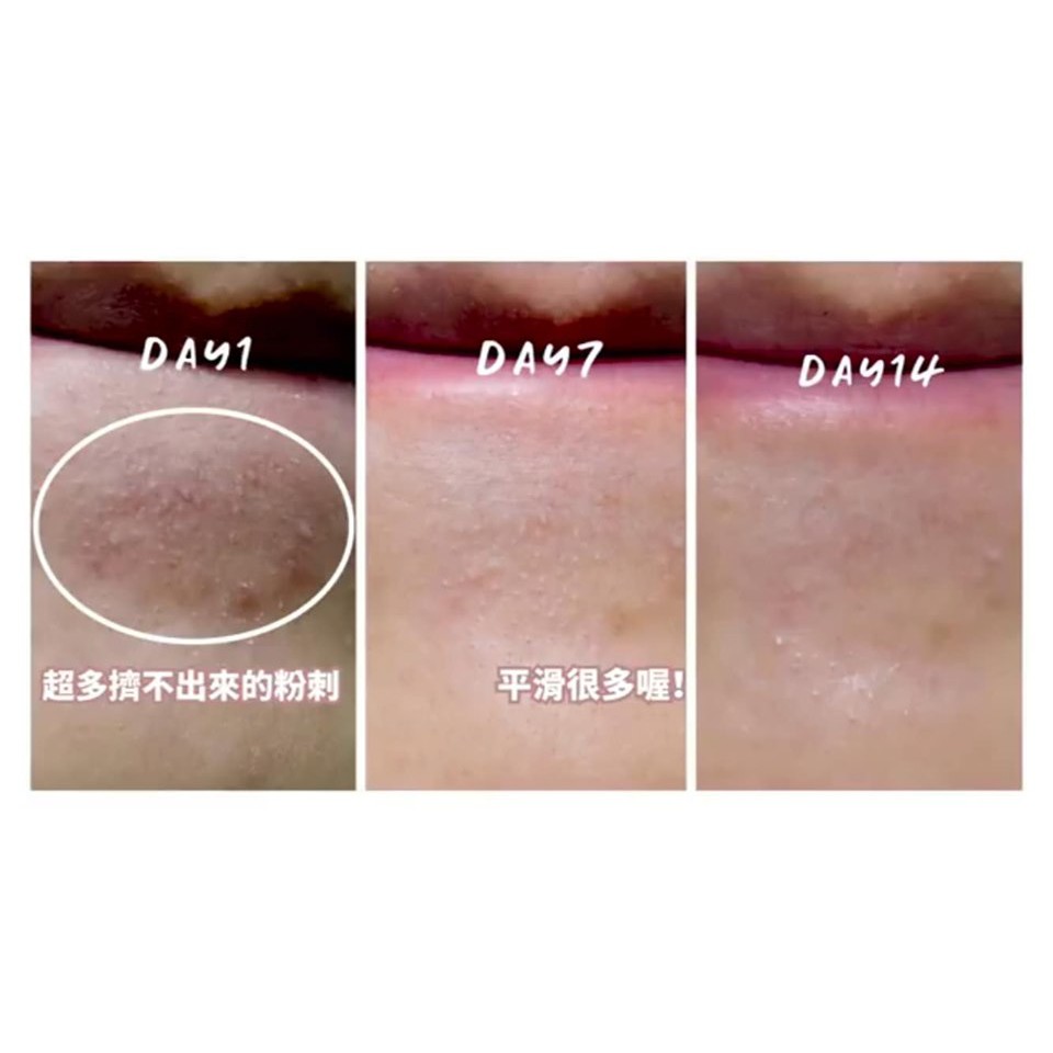 DR.WU Serum Tái Tạo Da Mandelic Acid 8% và 18%