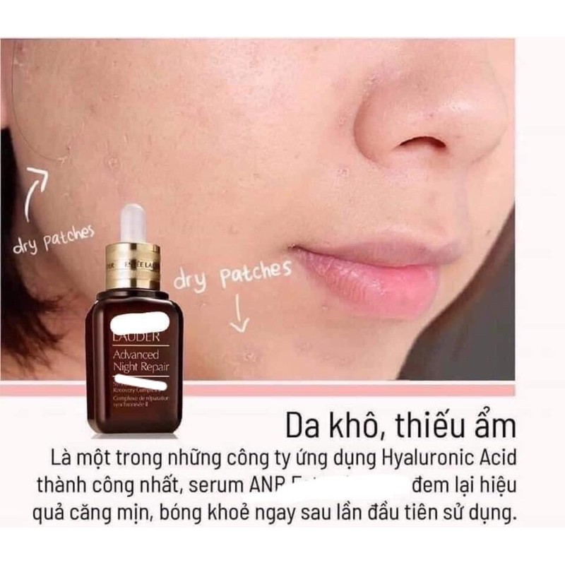 Tinh chất dưỡng da Estee Lauder Advanced Night Repair -7ML vòi pump