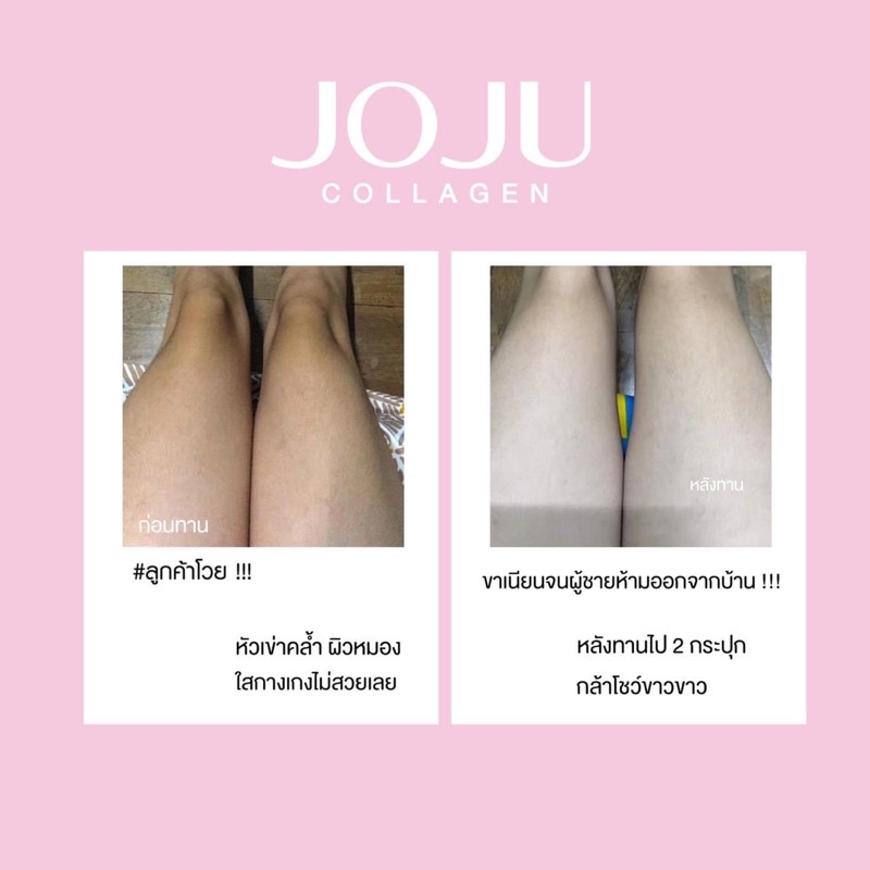 Viên uống duỡng da sáng khoẻ JOJU Collagen