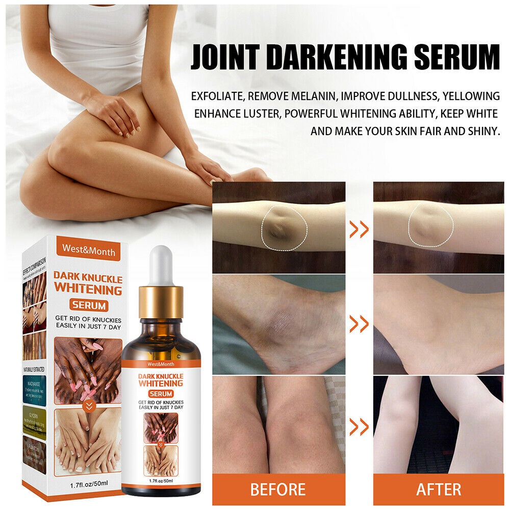 Serum Qipin Dưỡng Ẩm Làm Trắng Sáng Da Loại Bỏ Đốm Đen Trên Đầu Gối Ngón Tay / Đầu Gối 50ml