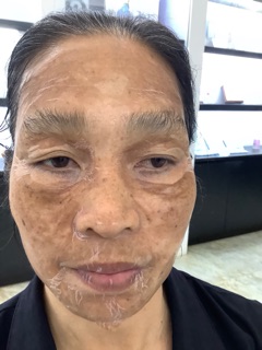 Set lẻ GEL NÂNG CƠ THẢI ĐỘC CARE CELLA