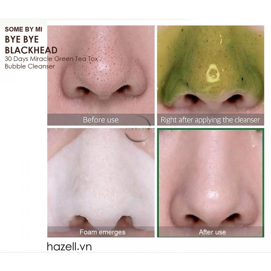 Sữa Rửa Mặt Sủi Bọt Hỗ Trợ đánh bay Mụn Đầu Đen Some By Mi Bye Bye Blackhead 30 Days 120gr | BigBuy360 - bigbuy360.vn