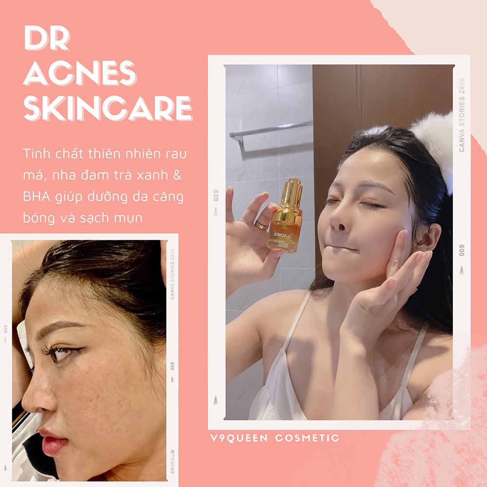 Serum giảm mụn mỹ phẩm cho bà bầu V9Queen tinh chất rau má mờ thâm dưỡng trắng da