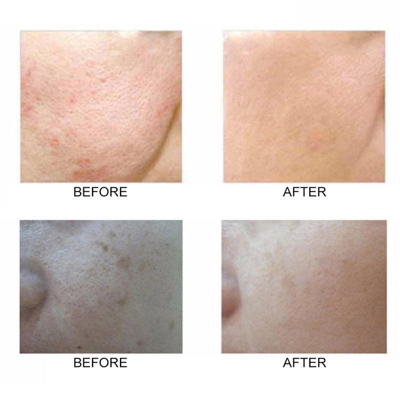 (Hàng Mới Về) 1 Cọ Rửa Mặt Hai Mặt Chất Liệu Silicon Tiện Dụng | BigBuy360 - bigbuy360.vn