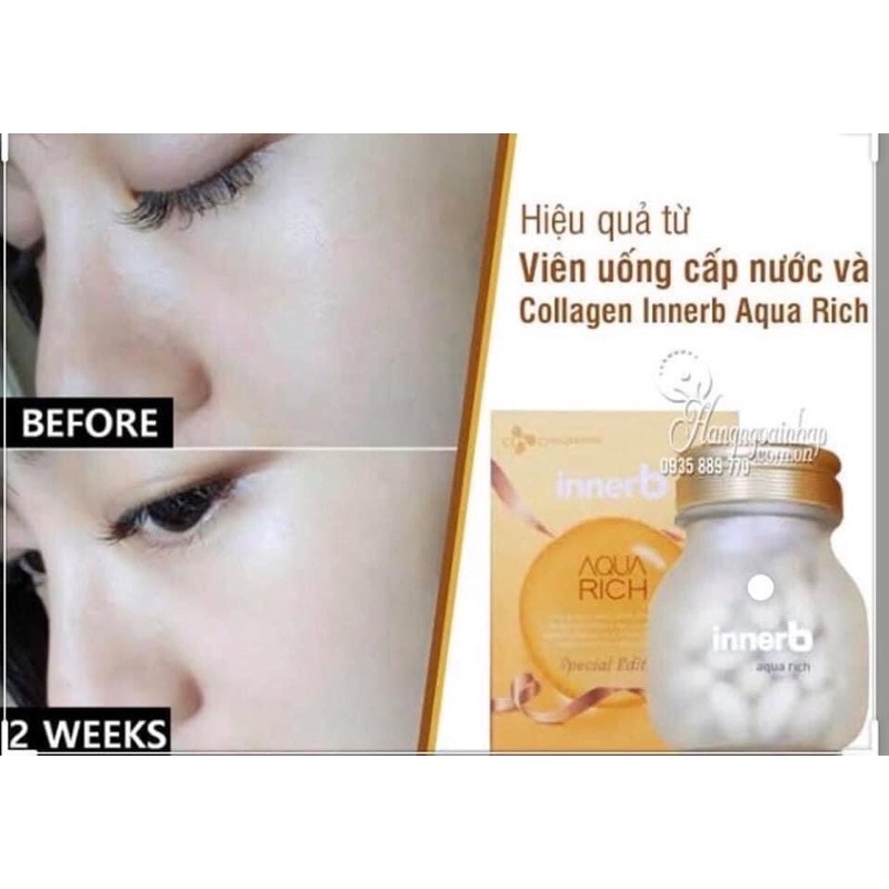 Viên cấp nước và collagen Aqua Rich Vàng 70v