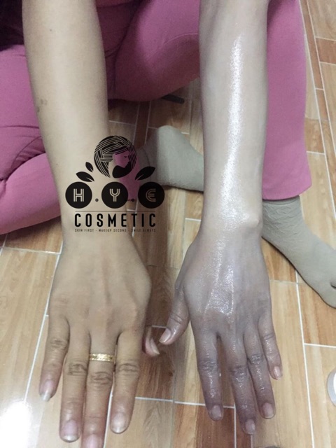 Ủ trắng body hye | BigBuy360 - bigbuy360.vn