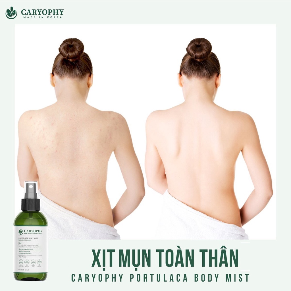 [CHÍNH HÃNG] Combo Xịt Ngừa Mụn Toàn Thân Caryophy Portulaca Body Mist 150ml + Serum Ngừa Mụn Caryophy Fullsize 10ml