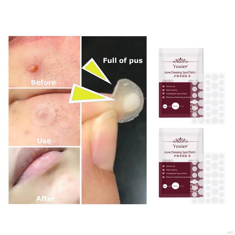 Face Patch Gel Patch Face Skin Care | BigBuy360 - bigbuy360.vn