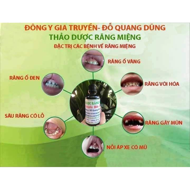 Thảo dược chà răng ố vàng, sún, sâu răng, nhiệt miệng cho trẻ em SR001