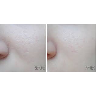 Kem Lót Che Khuyết Điểm Kiềm Dầu 3CE Pore Silky Balm 25g