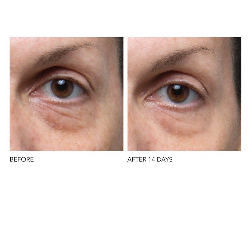 Serum mắt Dr. Dennis Gross Skincare Ferulic + Retinol Triple Correction Eye Serum giảm nhăn, bọng và săn da mắt | BigBuy360 - bigbuy360.vn