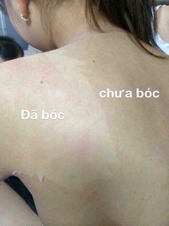thuốc lột thay da sinh học thái lan
