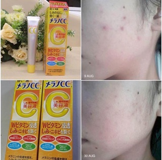 serum vitamin C #Melano CC Rohto