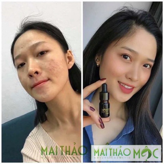 Combo tri mun Dr mai [CHÍNH HÃNG] ✅