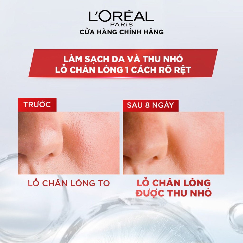 Nước Tẩy Trang L'Oréal Paris Dành Cho Da Dầu Revitalift Crystal Purifying Micellar Water 400ml
