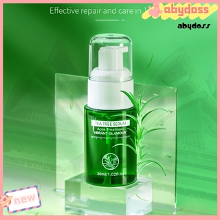 Serum trị mụn chiết xuất thực vật và trà xanh 30ml