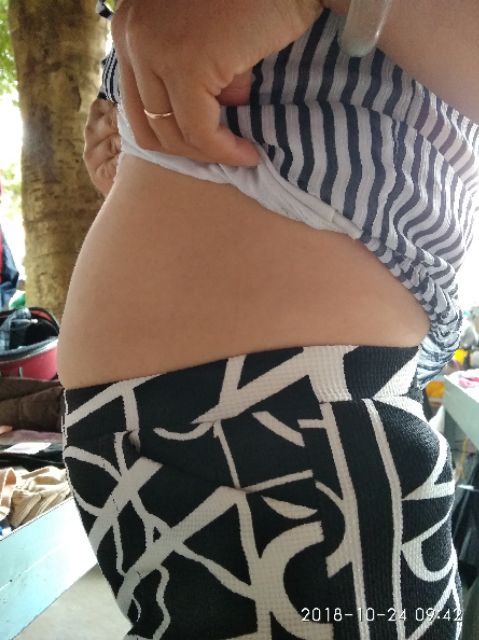 Gen nịt bụng thông hơi định hình/sau sinh | BigBuy360 - bigbuy360.vn