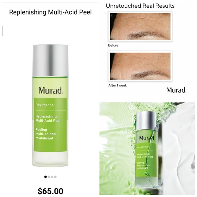 Tẩy da hoá học Murad REPLENISHING MULTI-ACID Peel 10ml | BigBuy360 - bigbuy360.vn
