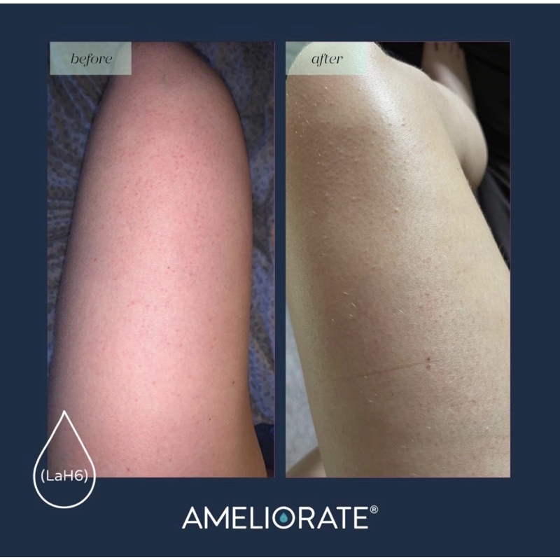 | TRẢ ORDER | SỮA DƯỠNG THỂ TRANSFORMING BODY LOTION AMELIORATE | BigBuy360 - bigbuy360.vn