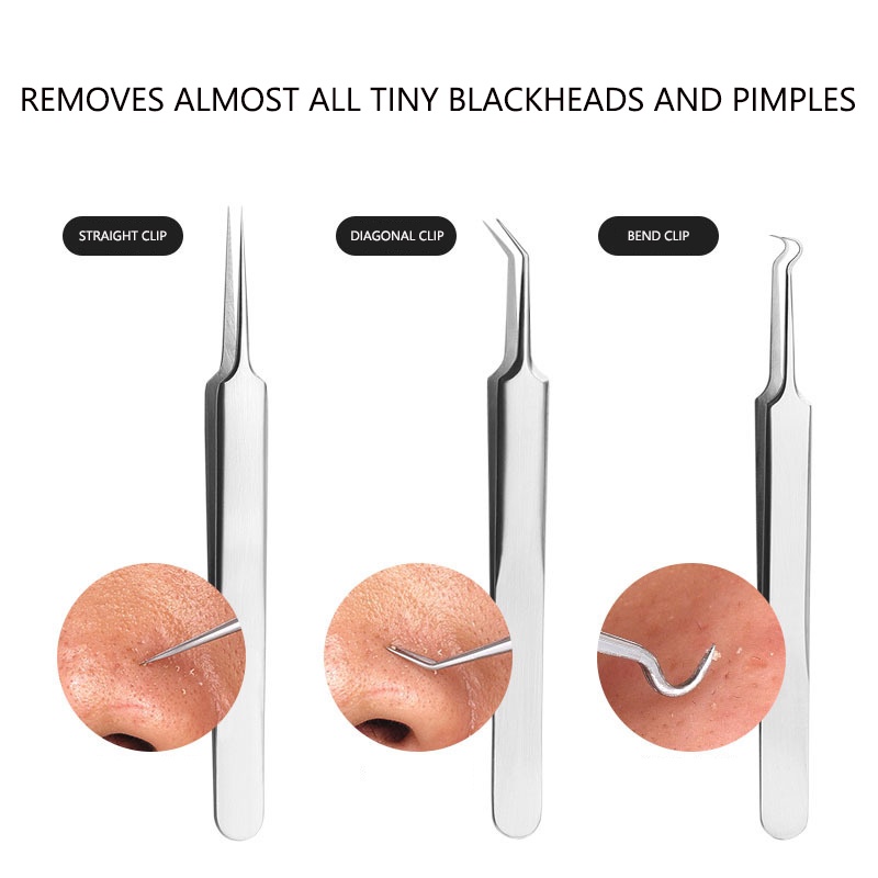 Bộ Dụng Cụ Loại Bỏ Mụn Đầu Đen Bằng Thép Không Gỉ